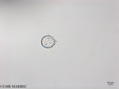 phyto/Brazilian_Nordeste/AtoldasRocas_station20/ABRACOS1 October 2015/Dinophysis exigua (ancien Phalacroma rotundatum -Snap-1770)(copy)_thumb.jpg